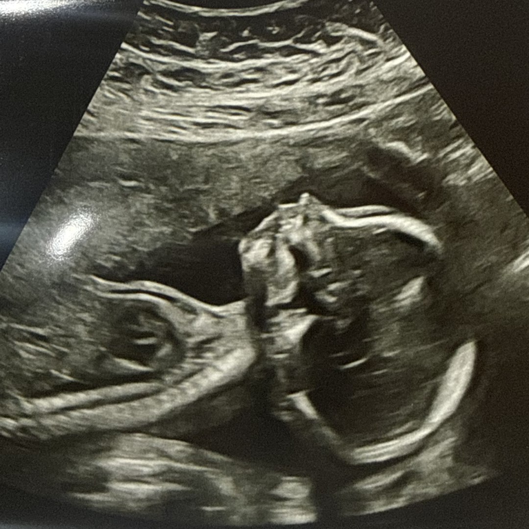 Photo shared by Anna-Kate for their Babylist baby registry.