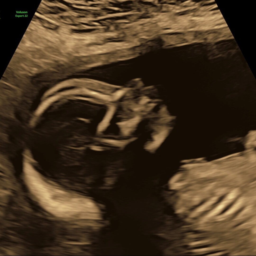 Photo shared by Cynthia for their Babylist baby registry.