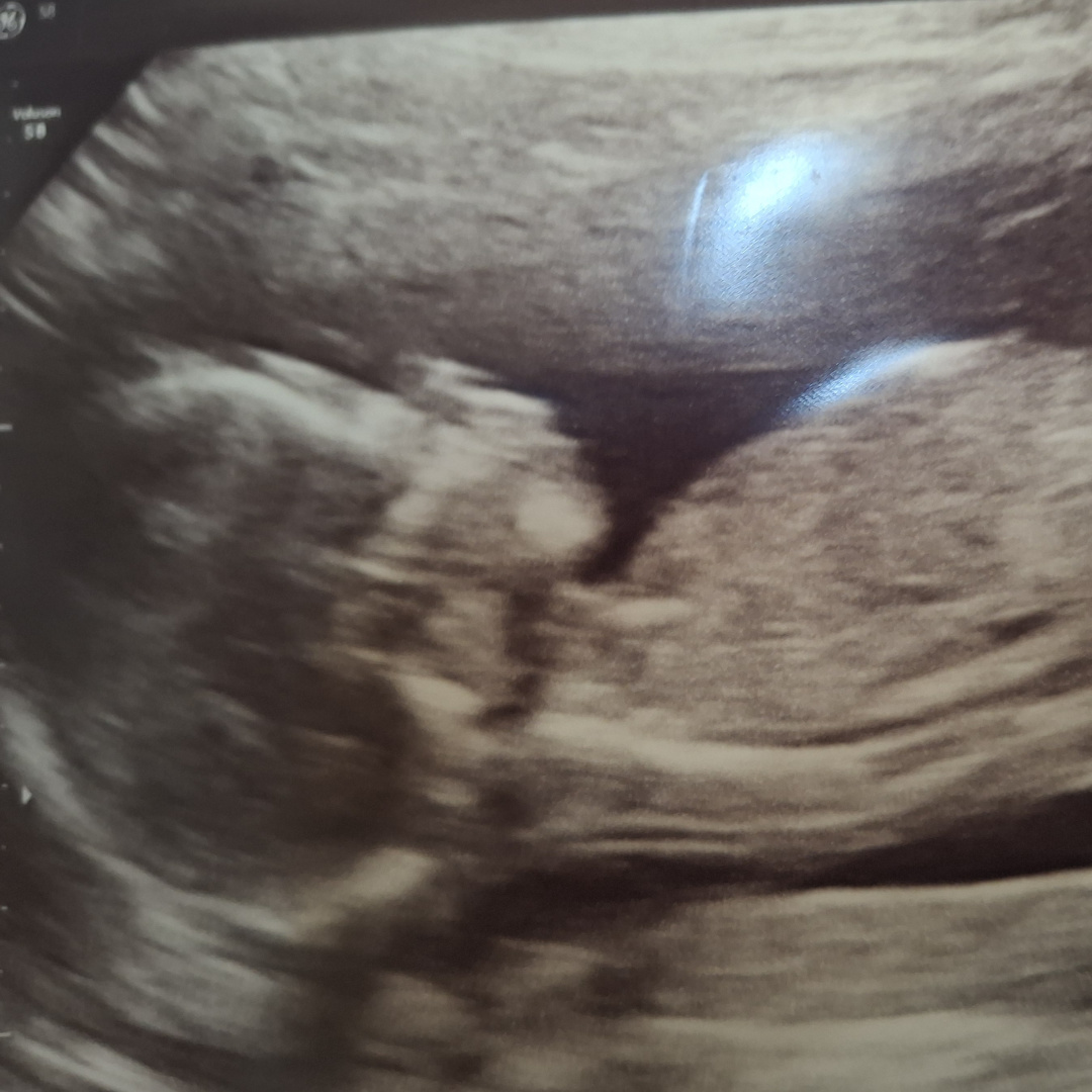 Photo shared by Patrice for their Babylist baby registry.