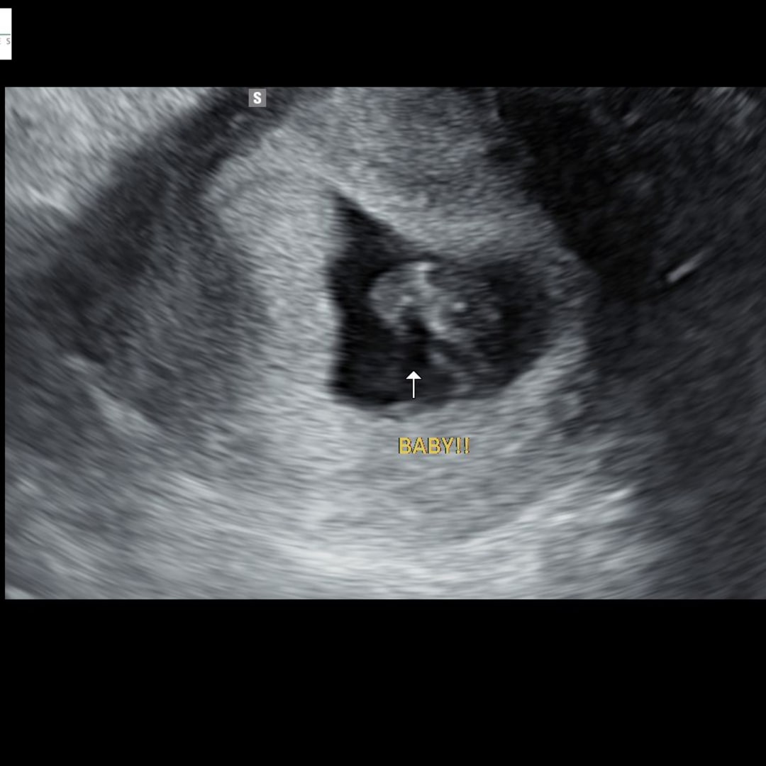 Photo shared by Annie for their Babylist baby registry.