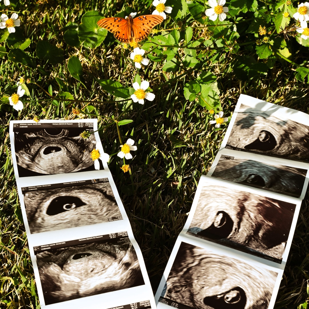 Photo shared by Lauren for their Babylist baby registry.