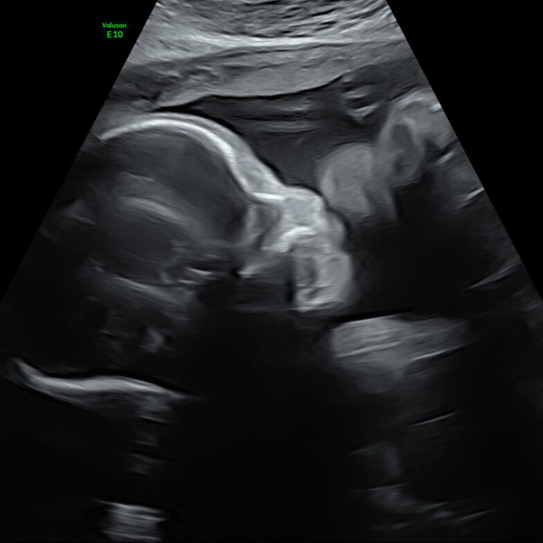 Photo shared by Zoey for their Babylist baby registry.