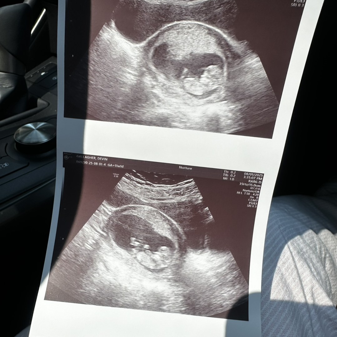 Photo shared by Devin for their Babylist baby registry.