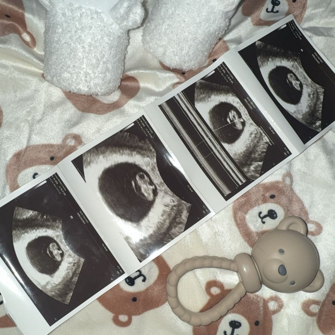 Photo shared by E and C for their Babylist baby registry.