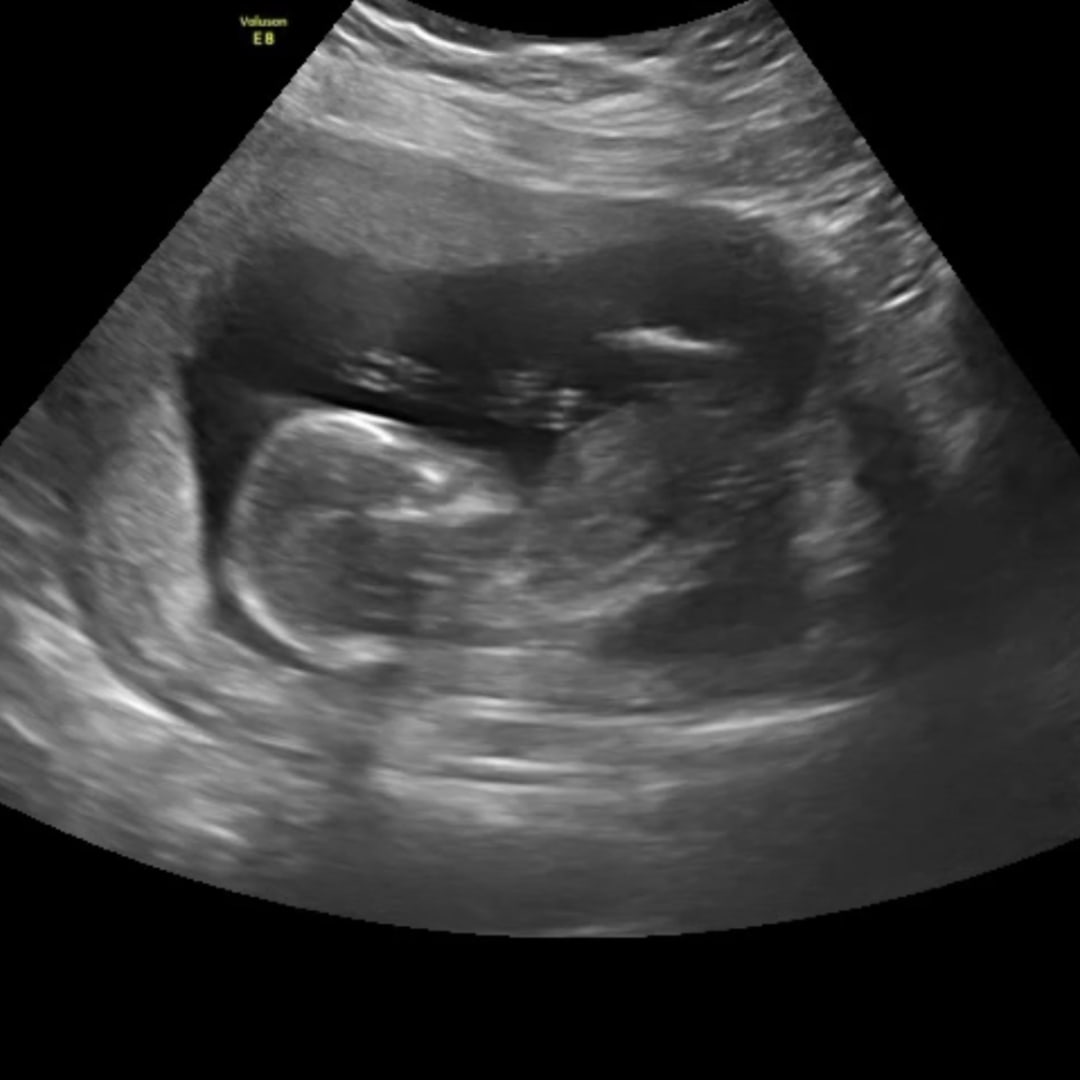 Photo shared by Dustee for their Babylist baby registry.