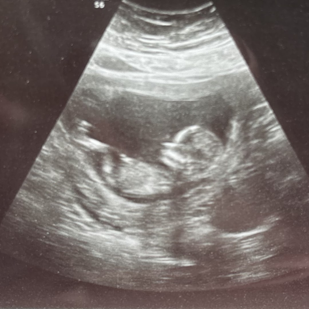 Photo shared by Karlee for their Babylist baby registry.