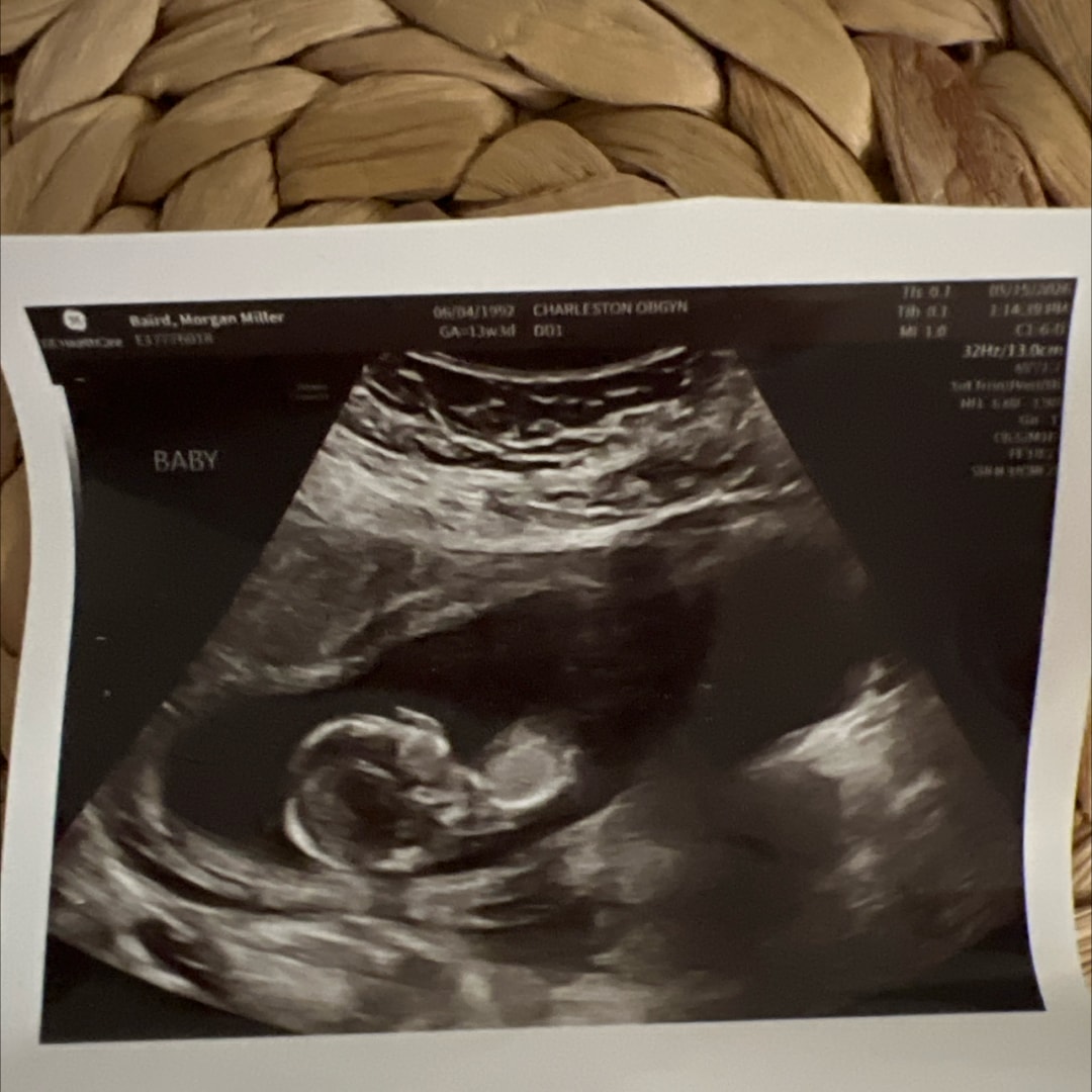 Photo shared by Morgan for their Babylist baby registry.