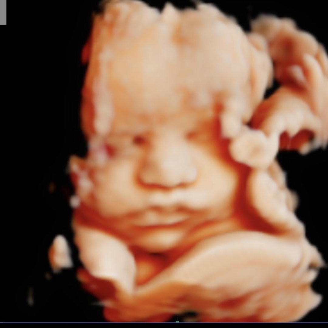 Photo shared by Kaitlyn for their Babylist baby registry.