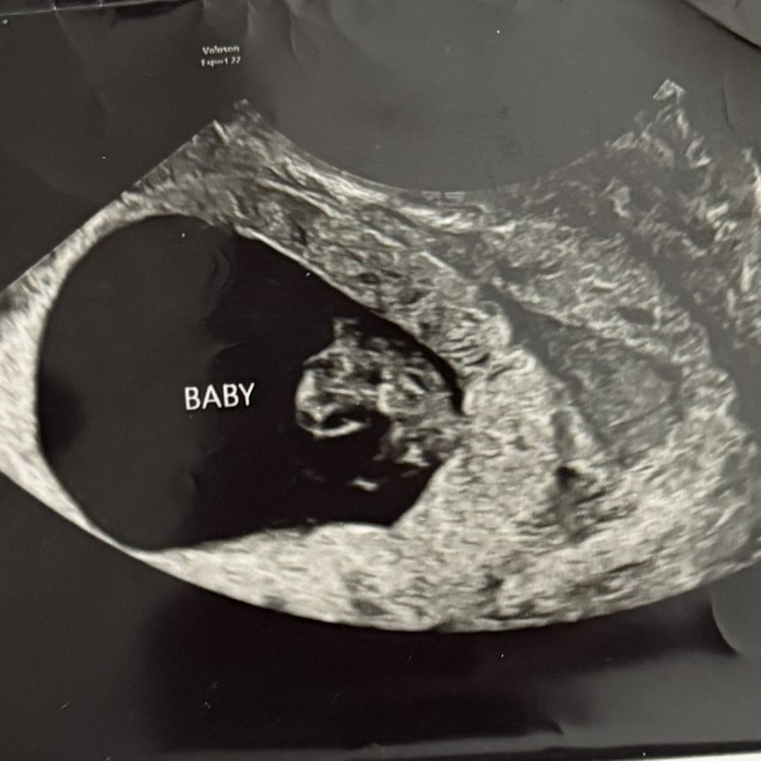 Photo shared by Katie for their Babylist baby registry.