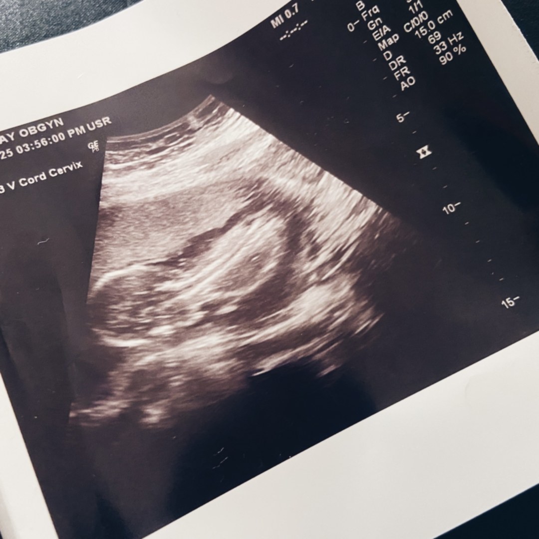 Photo shared by Sydney for their Babylist baby registry.