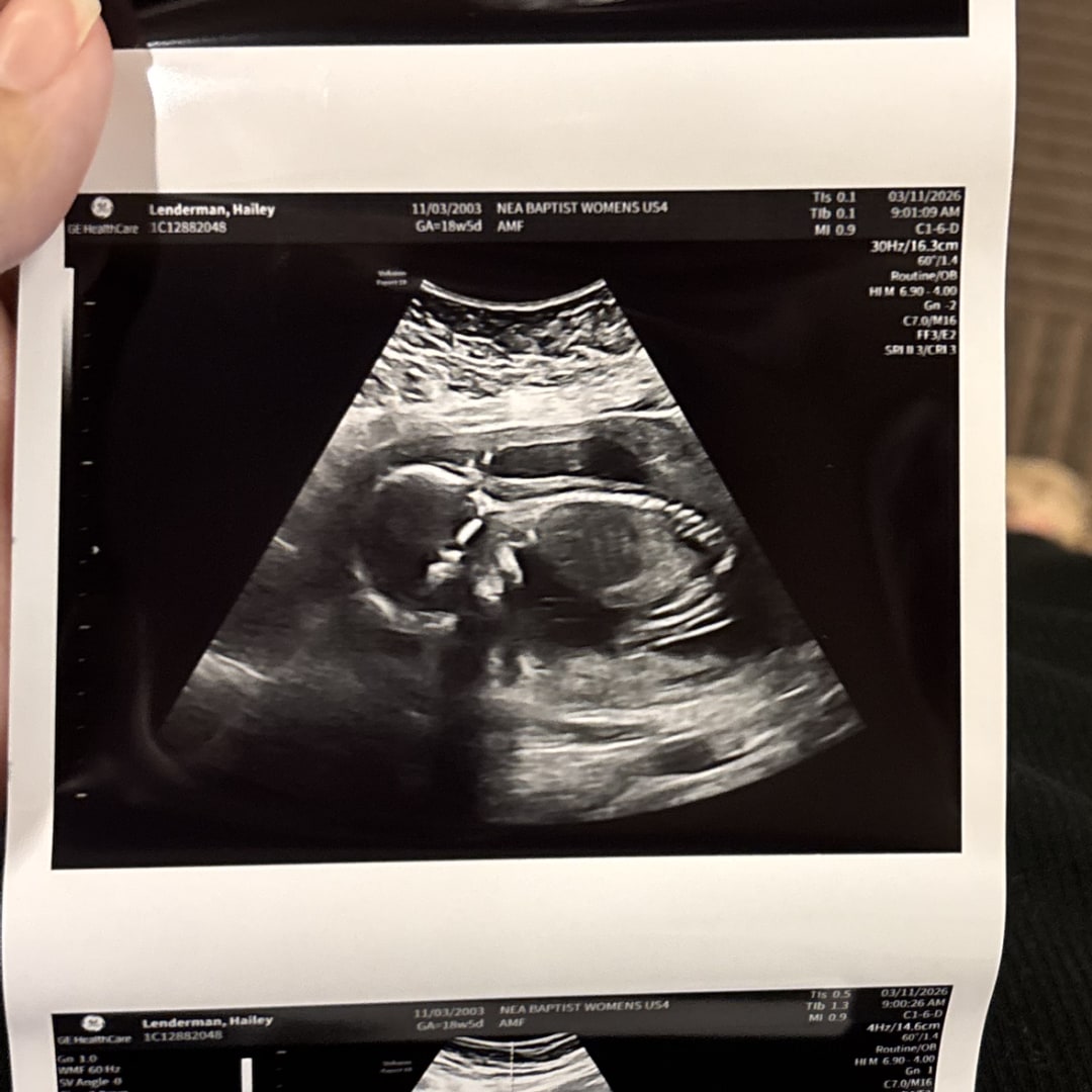 Photo shared by Hailey for their Babylist baby registry.