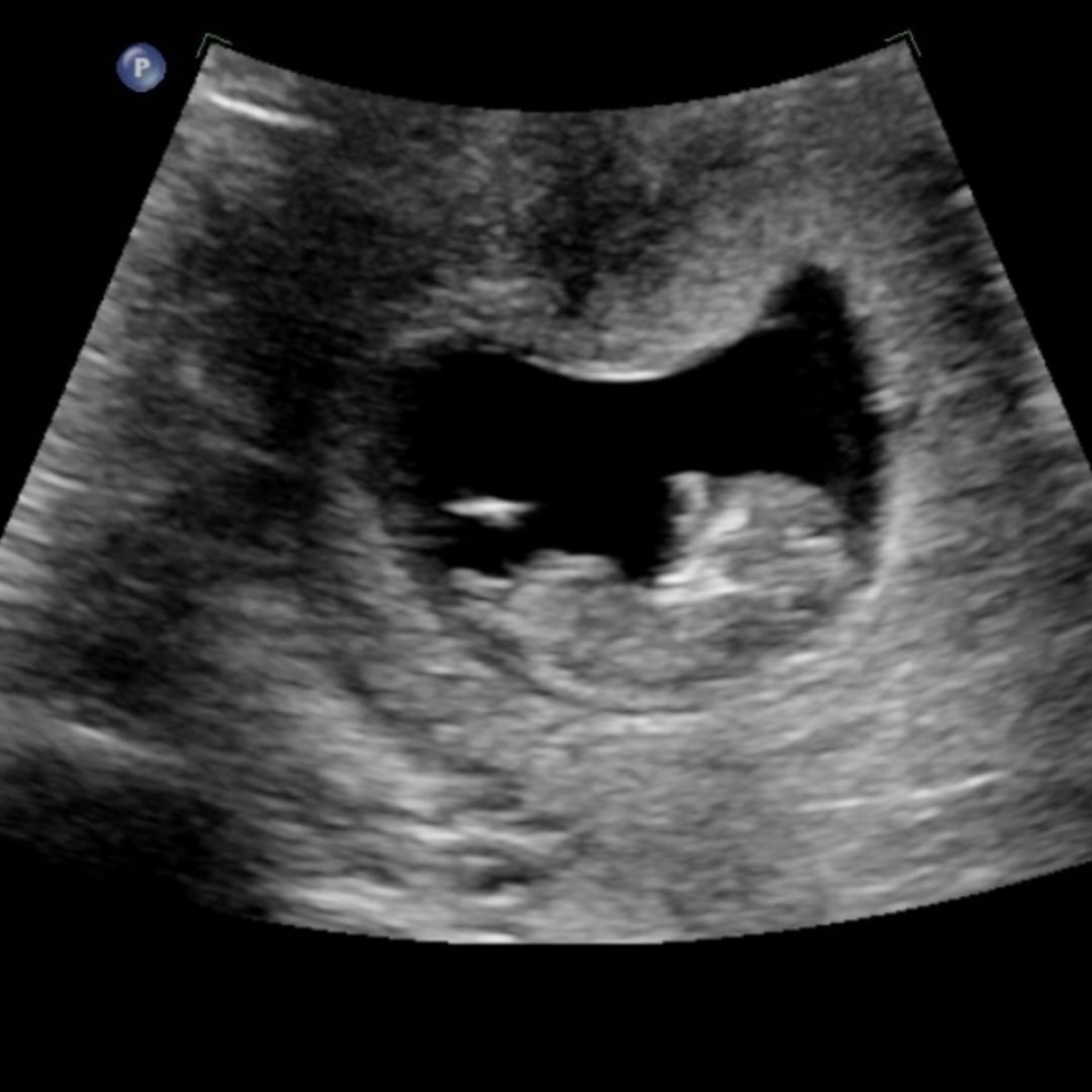 Photo shared by Abby for their Babylist baby registry.