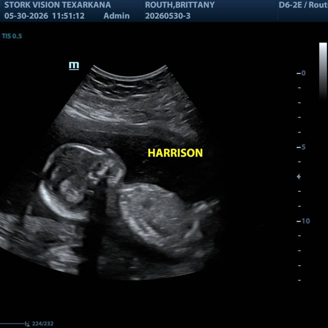 Photo shared by Brittany for their Babylist baby registry.