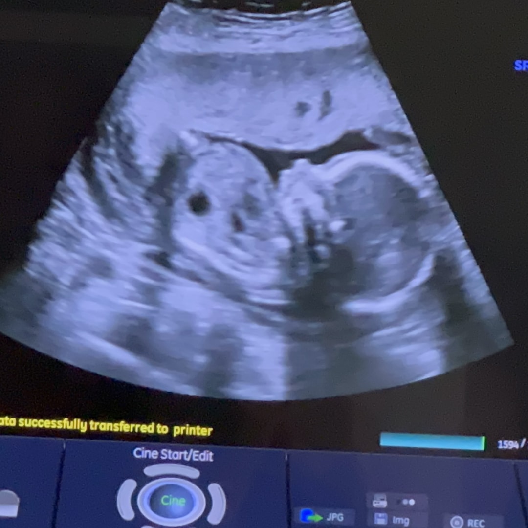 Photo shared by Mary for their Babylist baby registry.