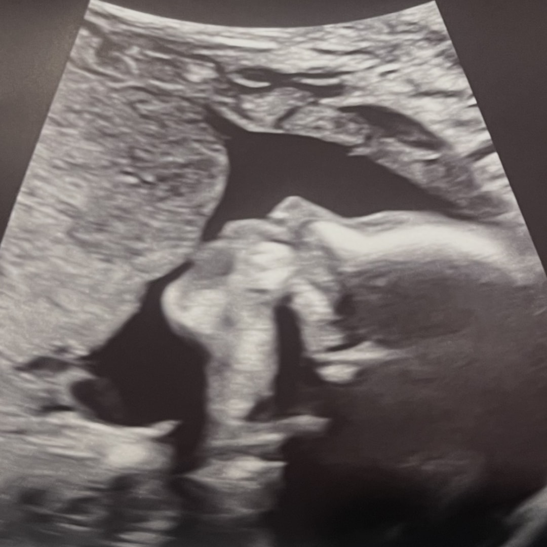 Photo shared by Janaya for their Babylist baby registry.