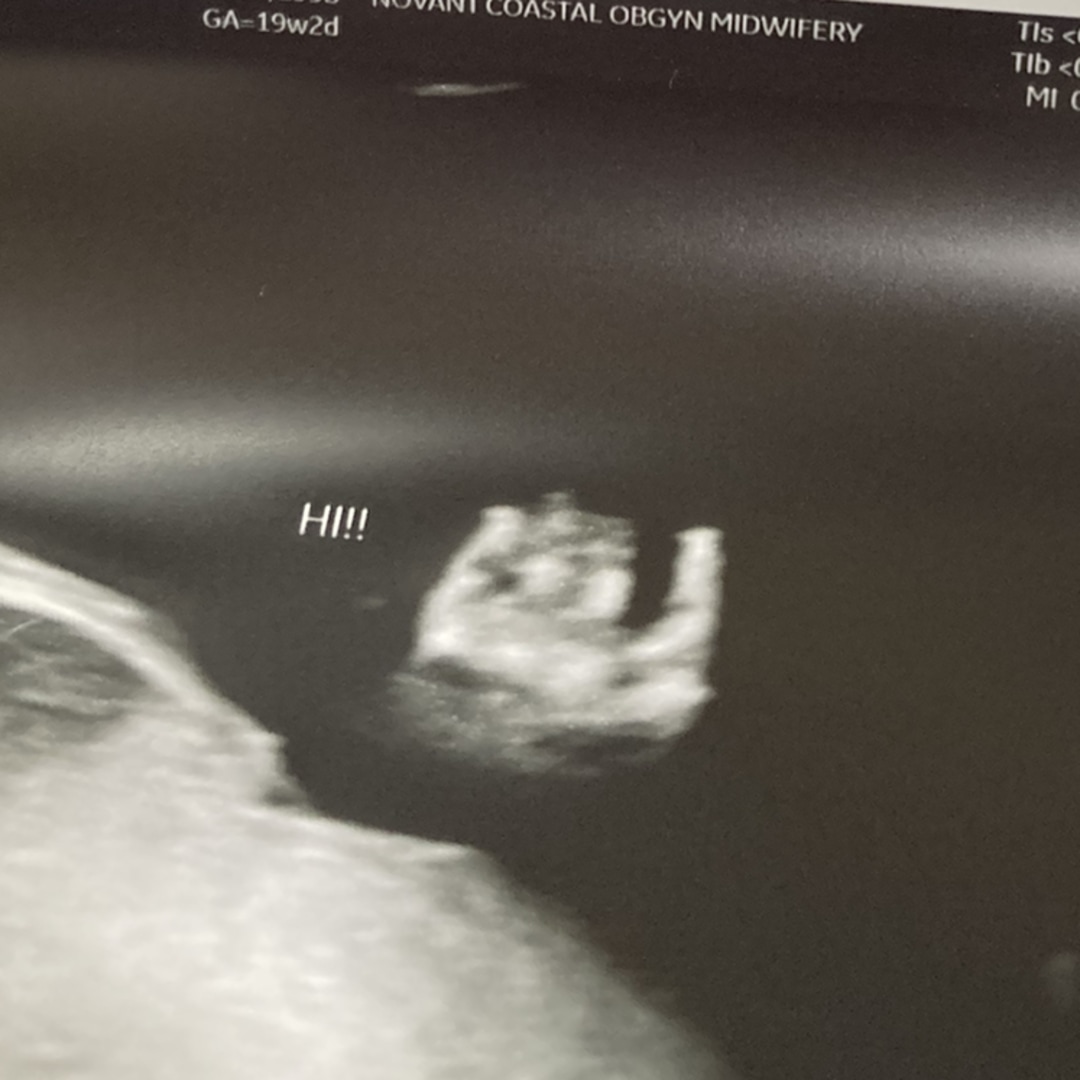 Photo shared by Abby for their Babylist baby registry.