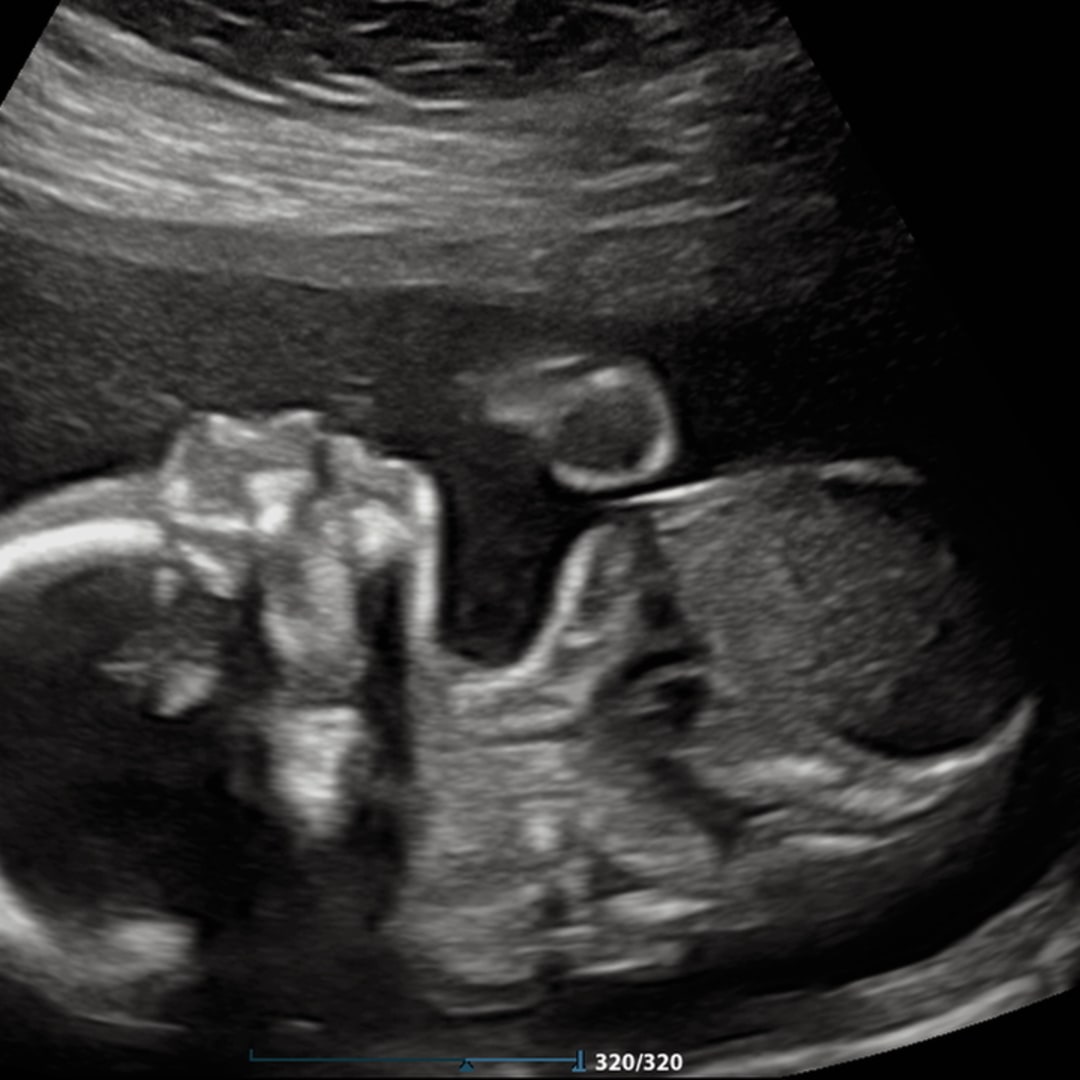 Photo shared by Jenna for their Babylist baby registry.