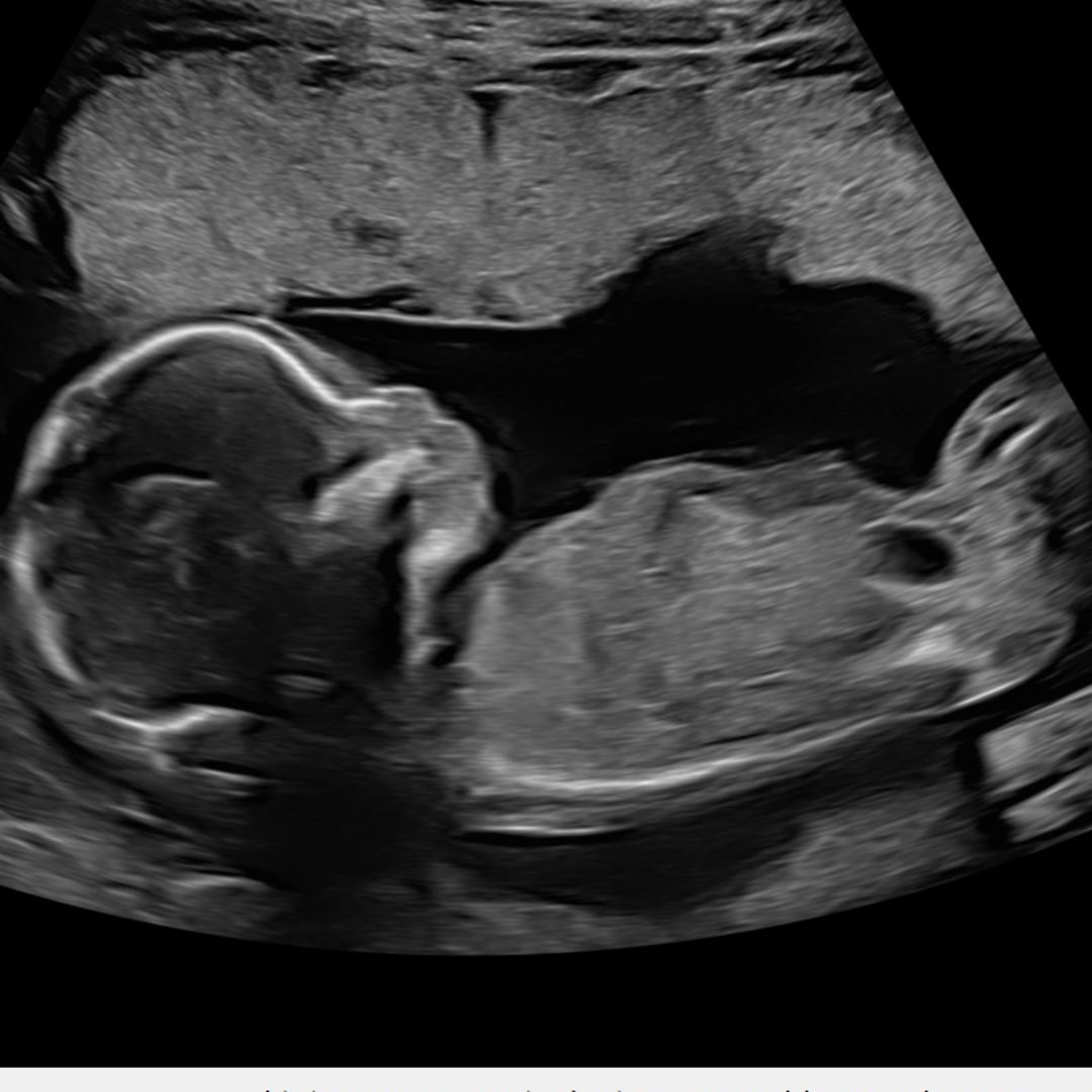 Photo shared by Manolya for their Babylist baby registry.