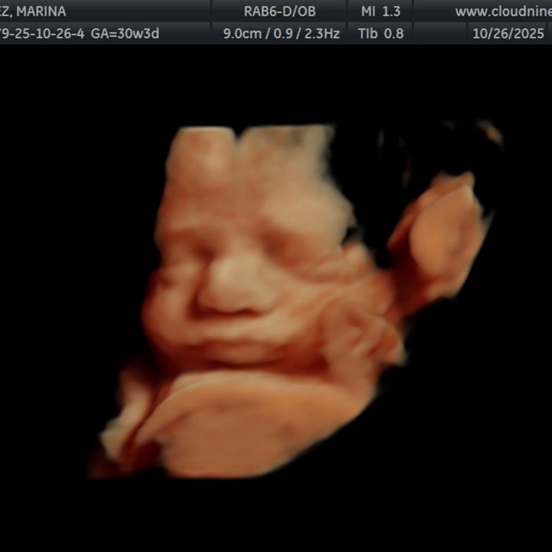 Photo shared by Marina for their Babylist baby registry.