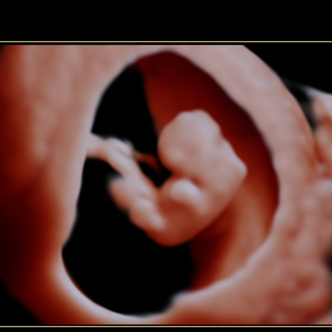 Photo shared by Lexi for their Babylist baby registry.