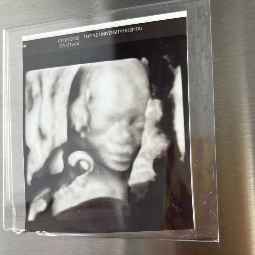 Photo shared by Myeesha for their Babylist baby registry.