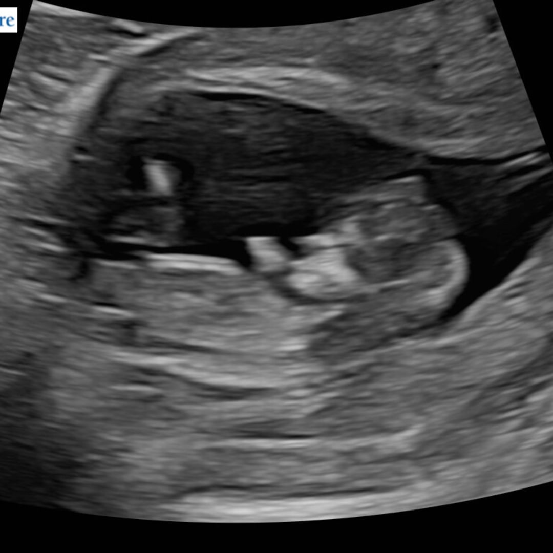 Photo shared by Ashlyn for their Babylist baby registry.