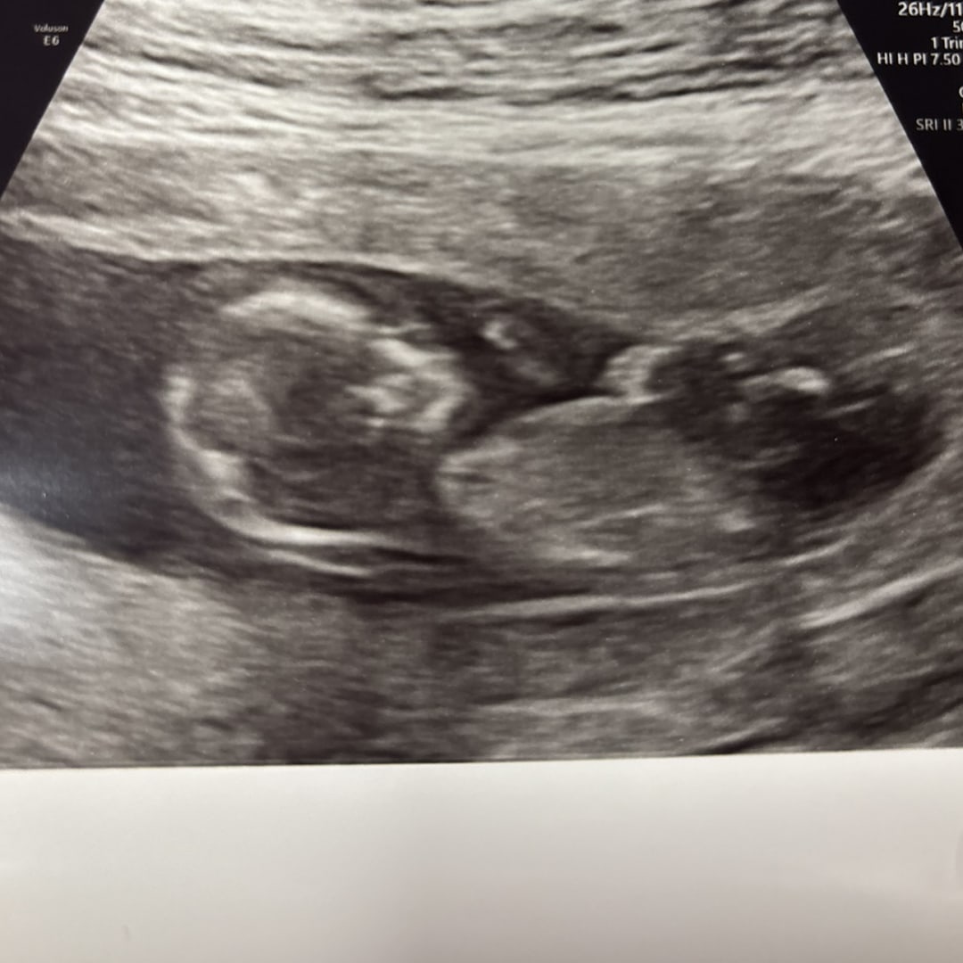 Photo shared by Madison for their Babylist baby registry.