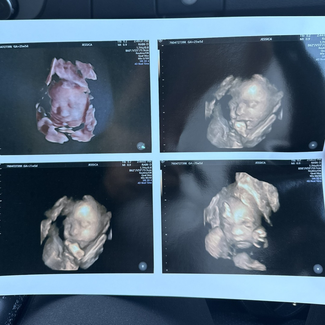 Photo shared by Madeline for their Babylist baby registry.