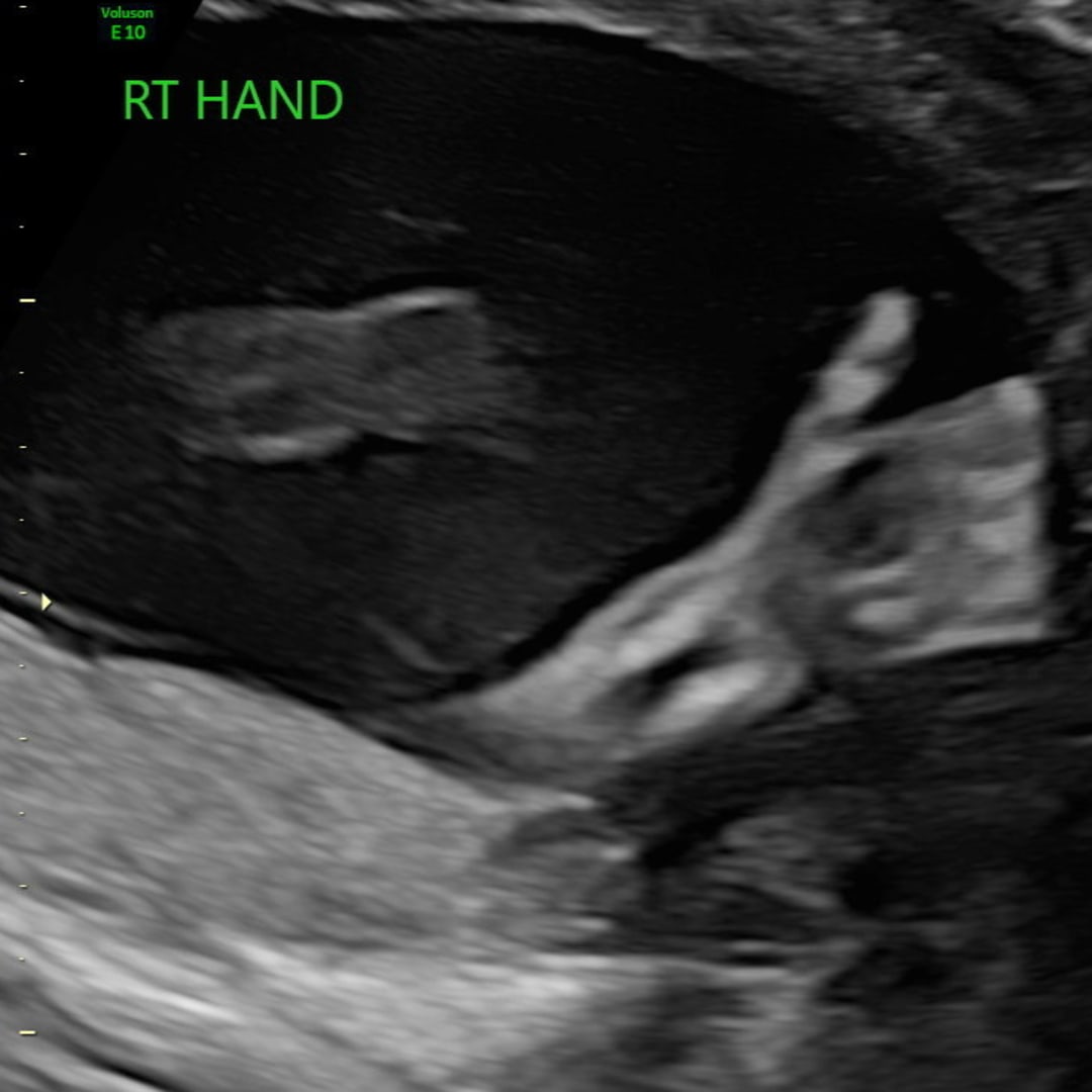 Photo shared by Alejandra for their Babylist baby registry.