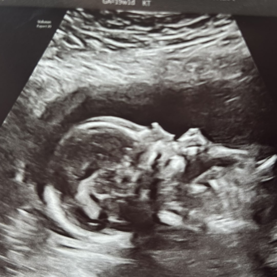 Photo shared by Maggie for their Babylist baby registry.