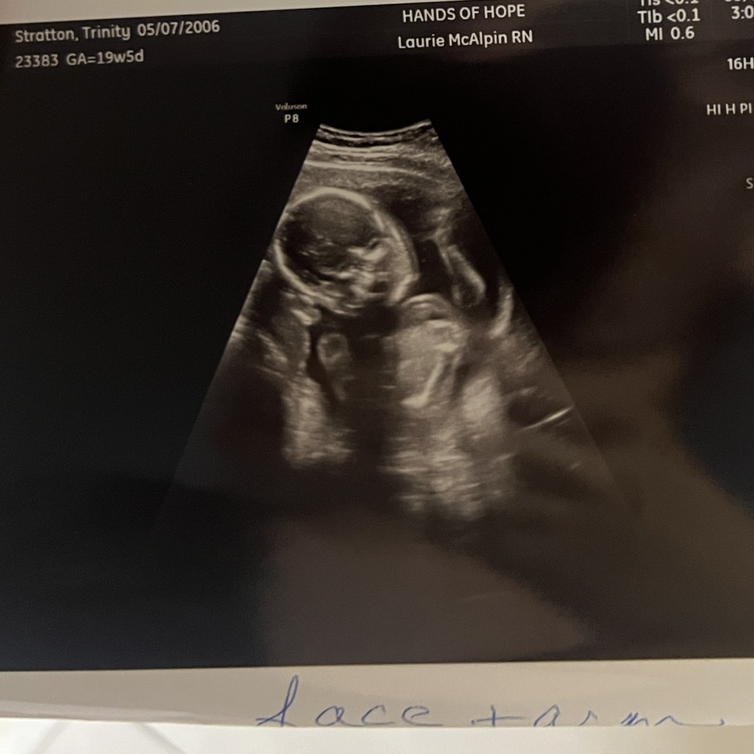 Photo shared by Trinity for their Babylist baby registry.