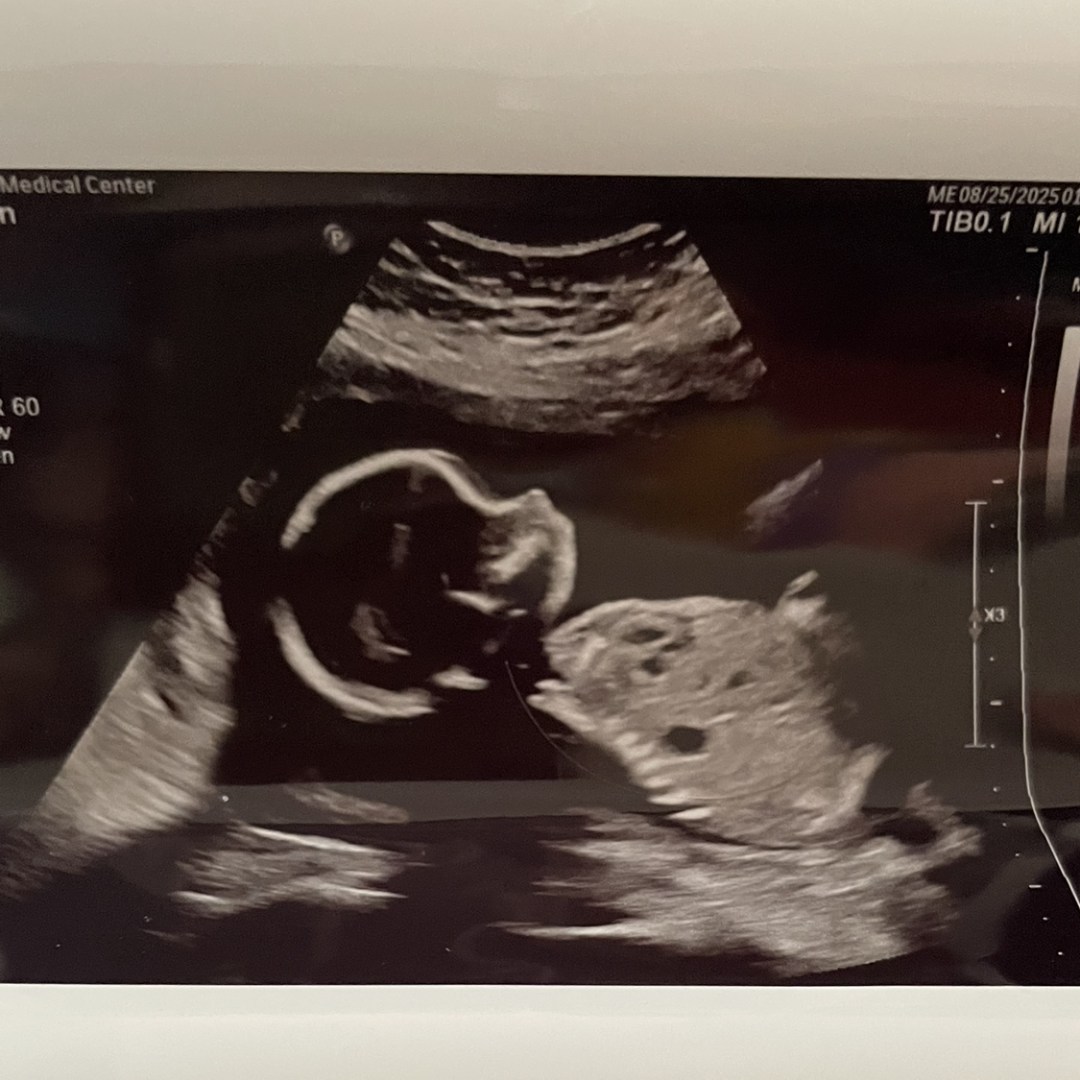 Photo shared by Alexandrea for their Babylist baby registry.