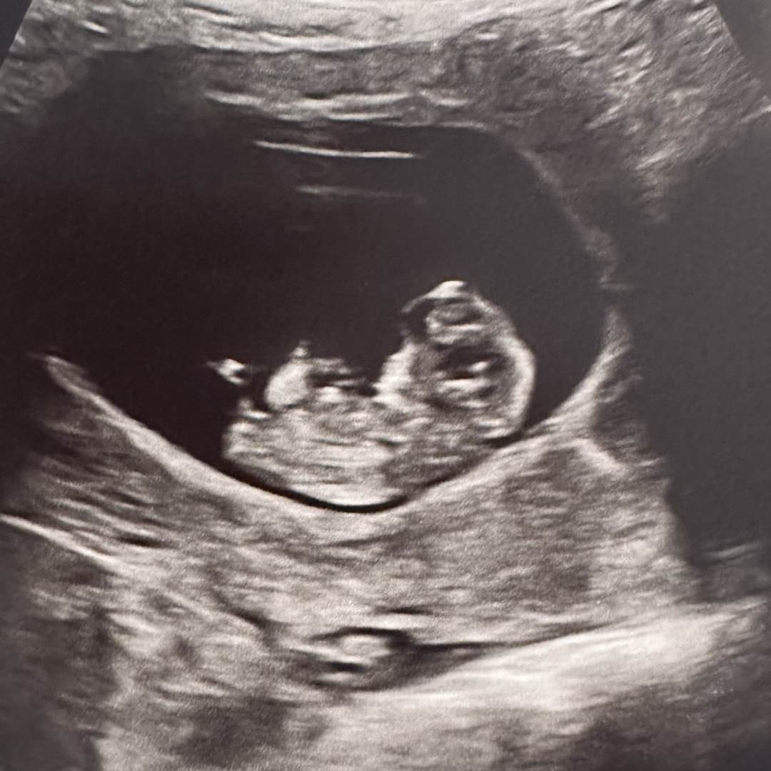 Photo shared by MELISSA for their Babylist baby registry.