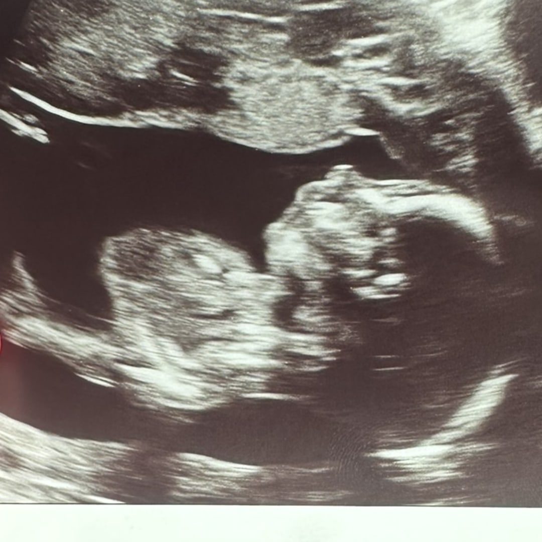 Photo shared by Hailey for their Babylist baby registry.