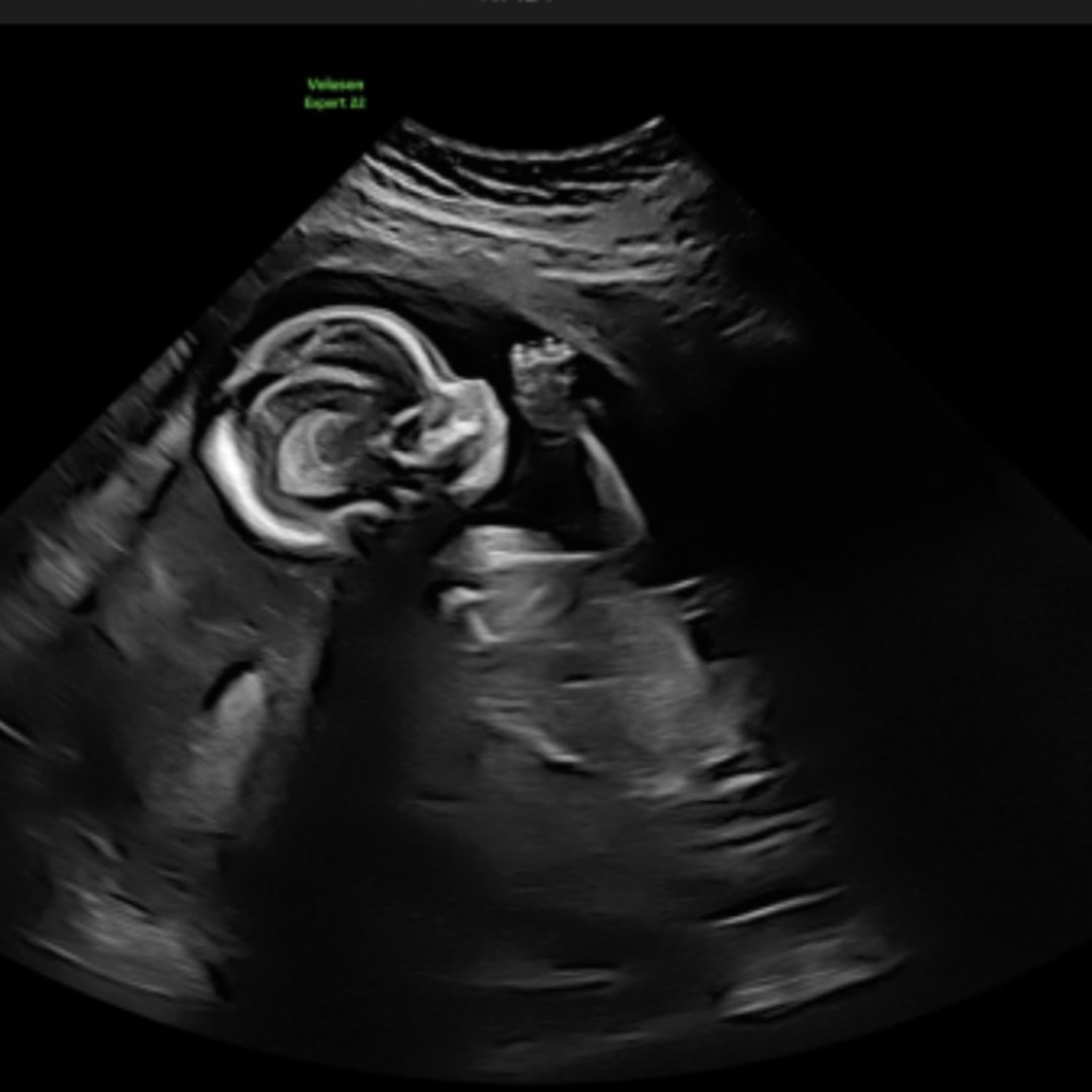 Photo shared by Cameron for their Babylist baby registry.