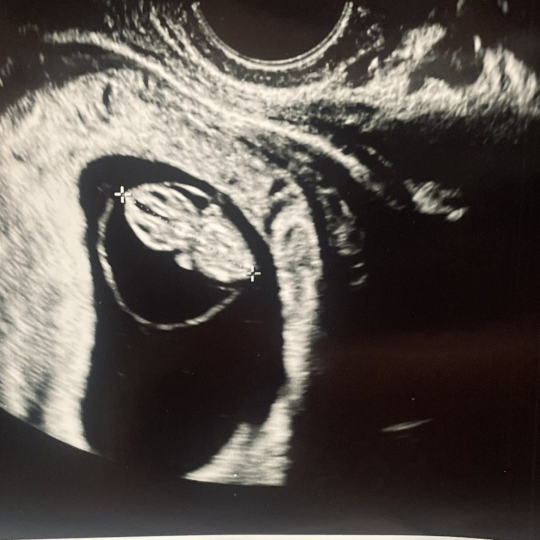 Photo shared by Leslie for their Babylist baby registry.