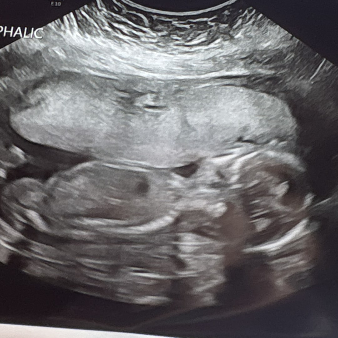 Photo shared by Marilee for their Babylist baby registry.