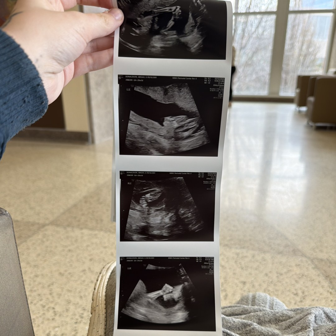 Photo shared by Abbie for their Babylist baby registry.