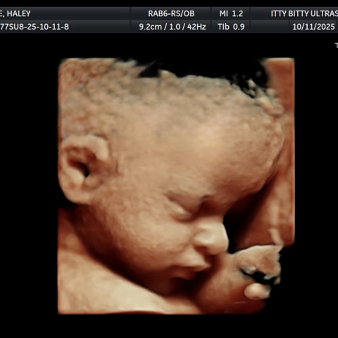 Photo shared by Haley for their Babylist baby registry.