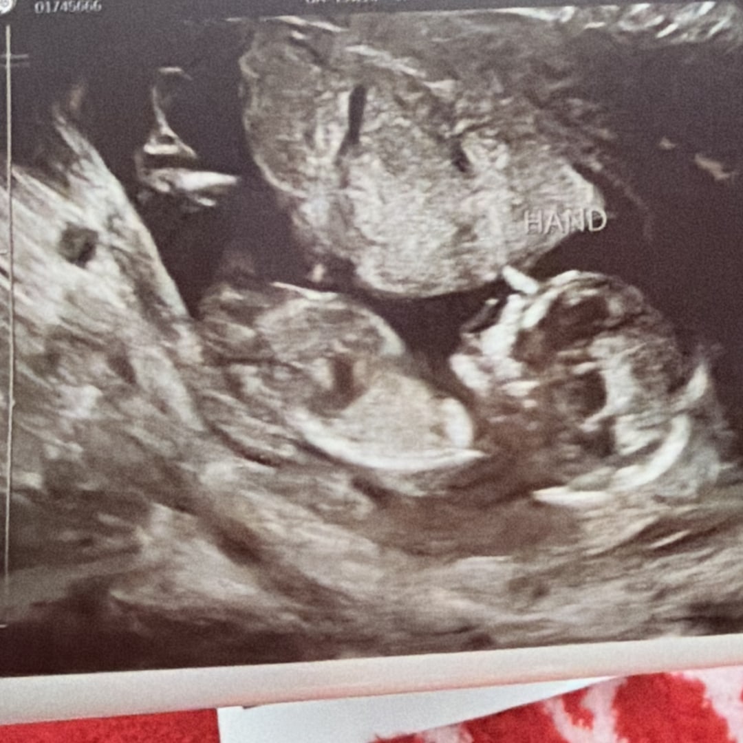 Photo shared by Angela for their Babylist baby registry.