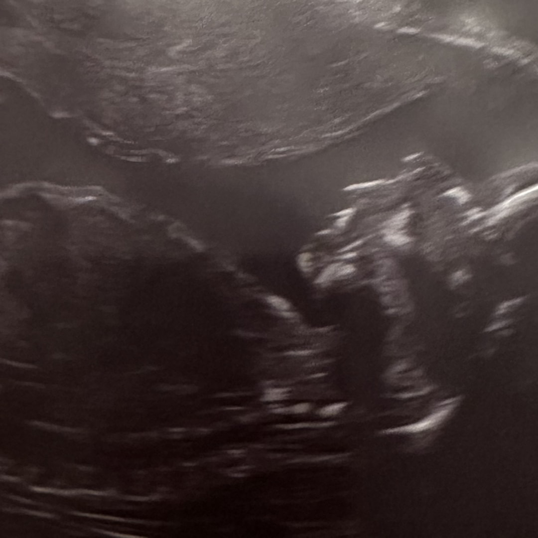 Photo shared by Melanie for their Babylist baby registry.