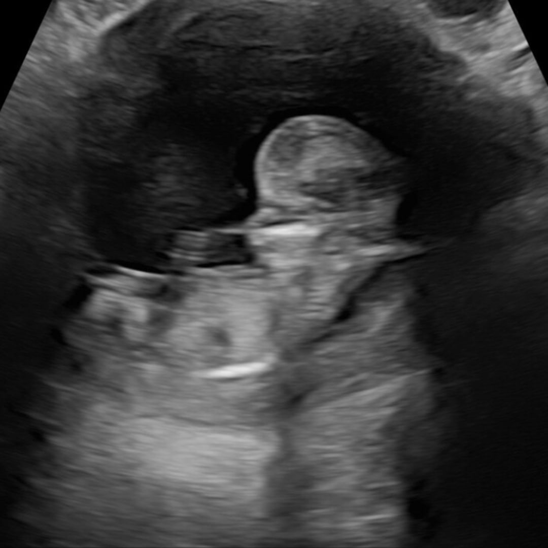 Photo shared by Anna Marie for their Babylist baby registry.