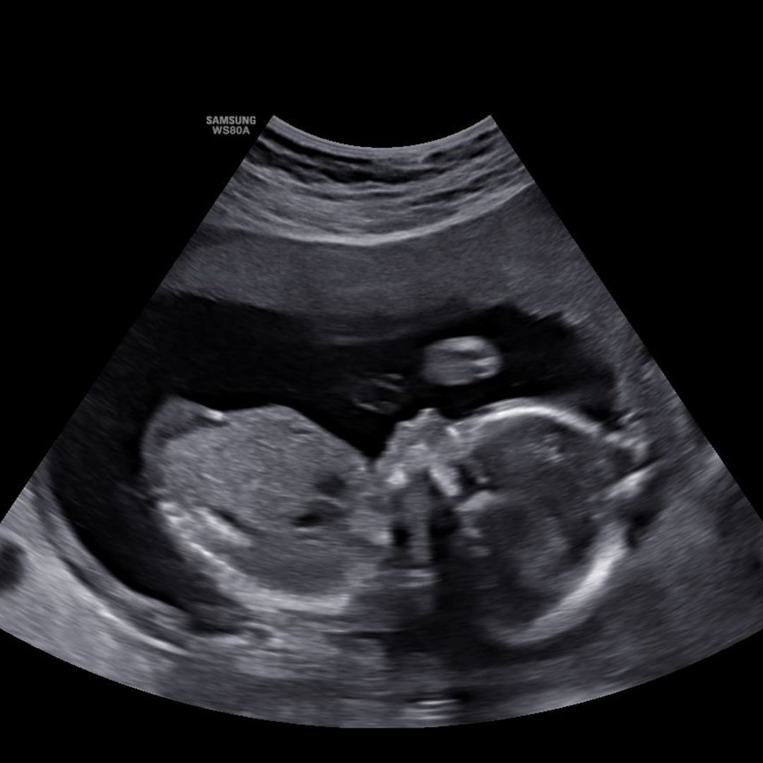 Photo shared by Kati for their Babylist baby registry.