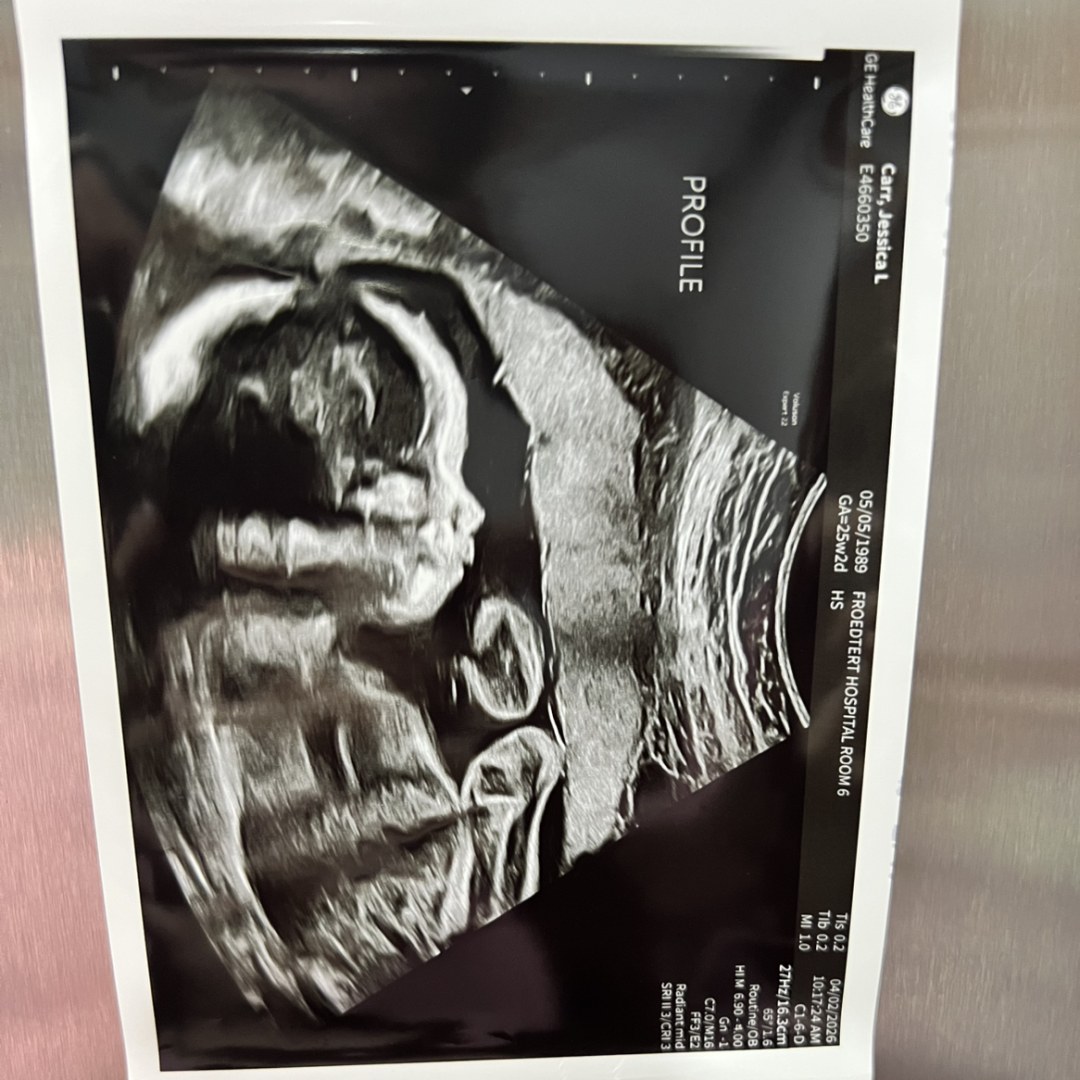 Photo shared by Stephen for their Babylist baby registry.