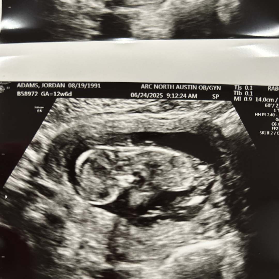 Photo shared by Jordan for their Babylist baby registry.