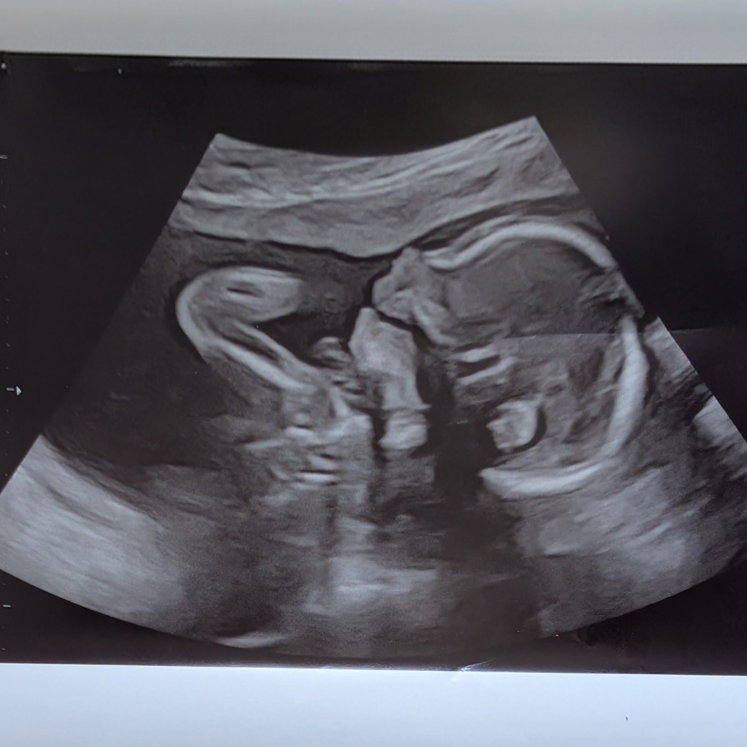 Photo shared by Christie for their Babylist baby registry.