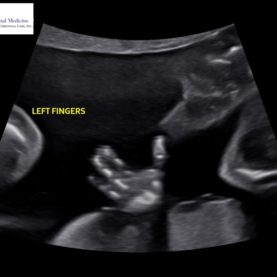 Photo shared by Tahj for their Babylist baby registry.