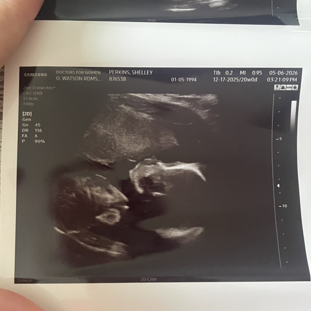 Photo shared by Shelley for their Babylist baby registry.