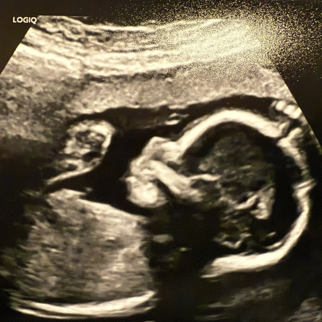 Photo shared by Kalynn for their Babylist baby registry.