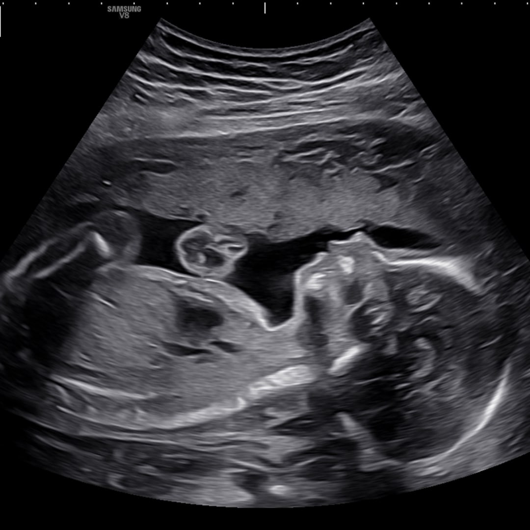 Photo shared by Madelyn for their Babylist baby registry.